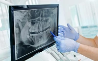 Tipps bei Zahnimplantaten